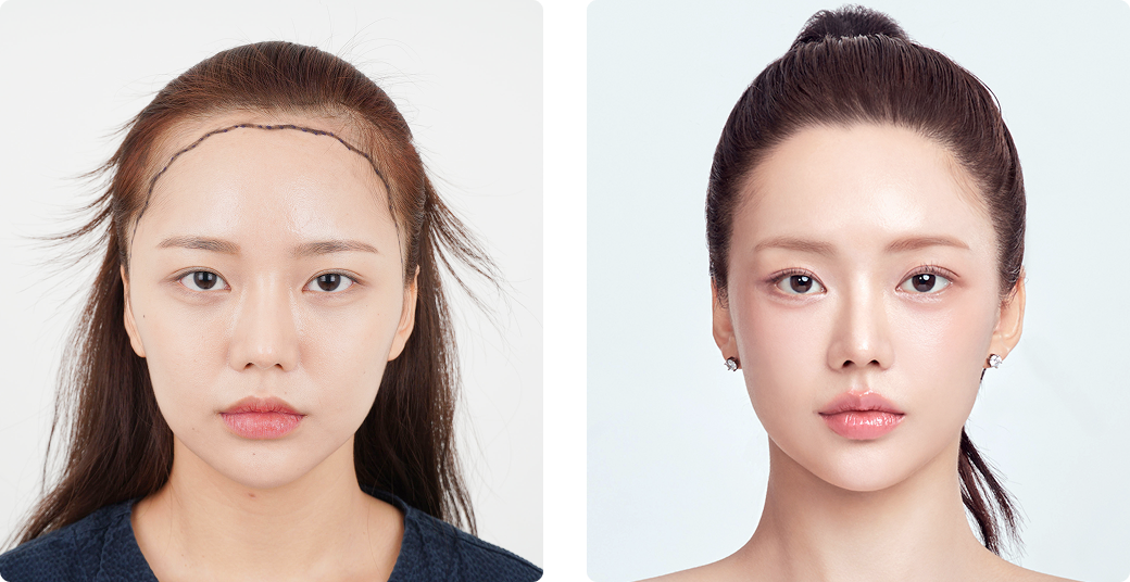 리얼포토후기 정면