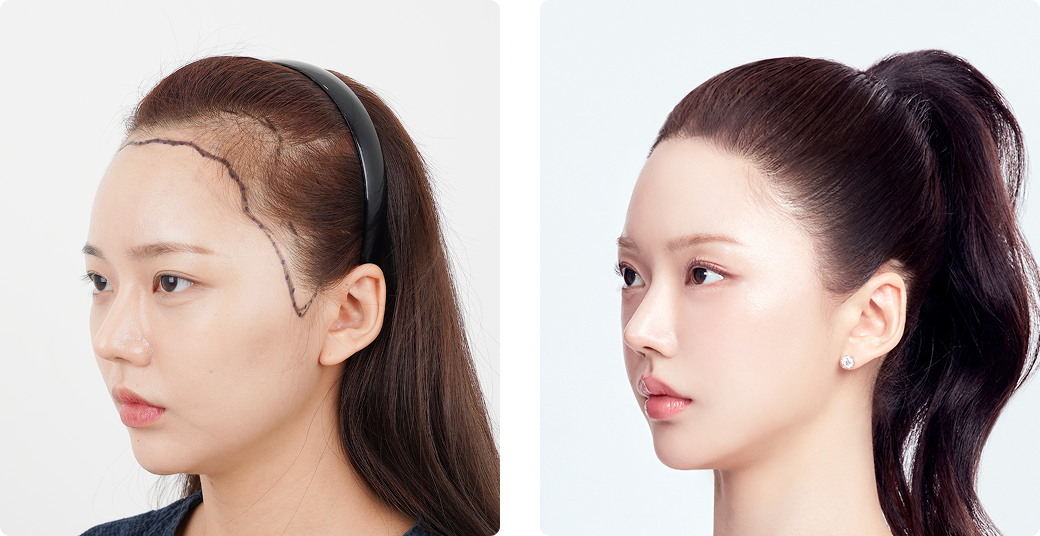 리얼포토후기 측면