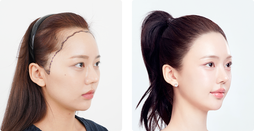 리얼포토후기 측면