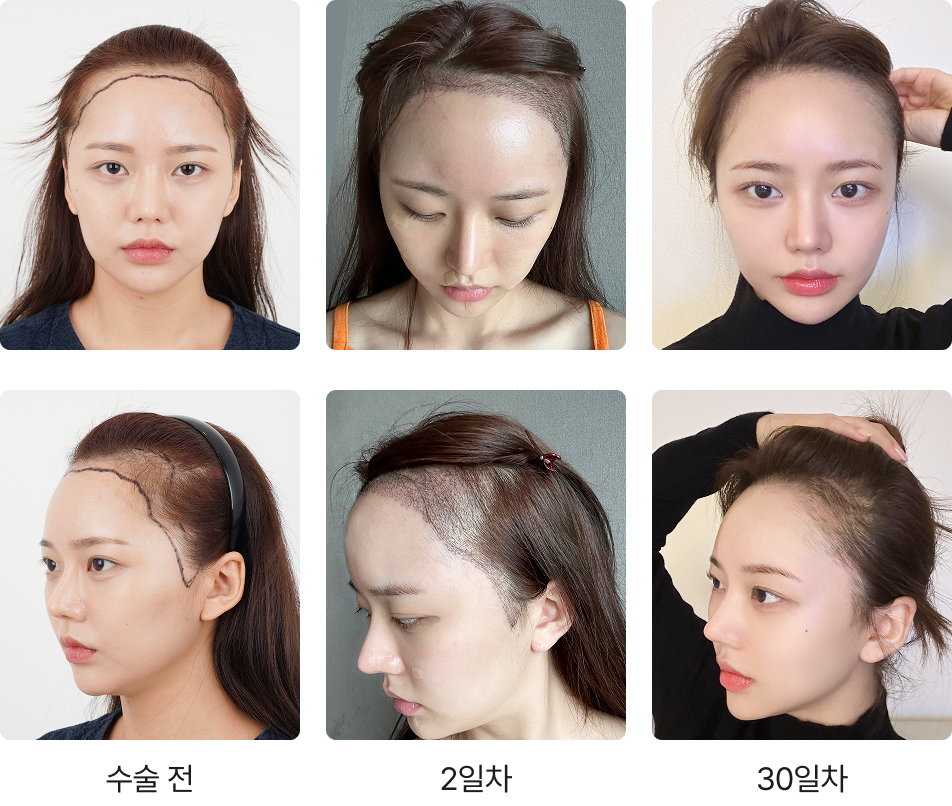 321일 간의 리얼 변화