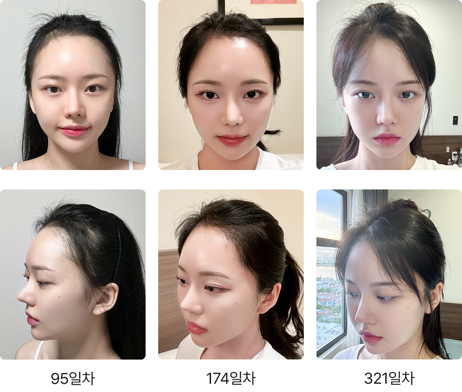 321일 간의 리얼 변화