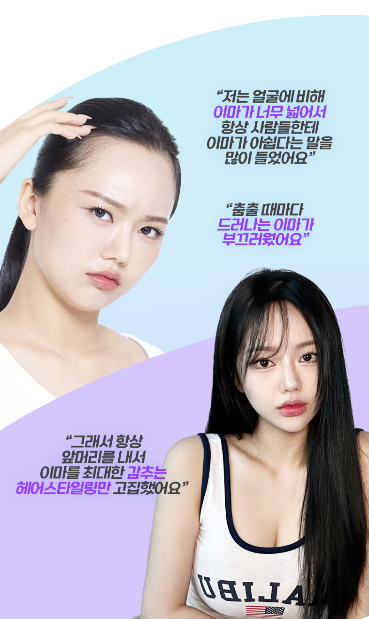 모발이식 필요성