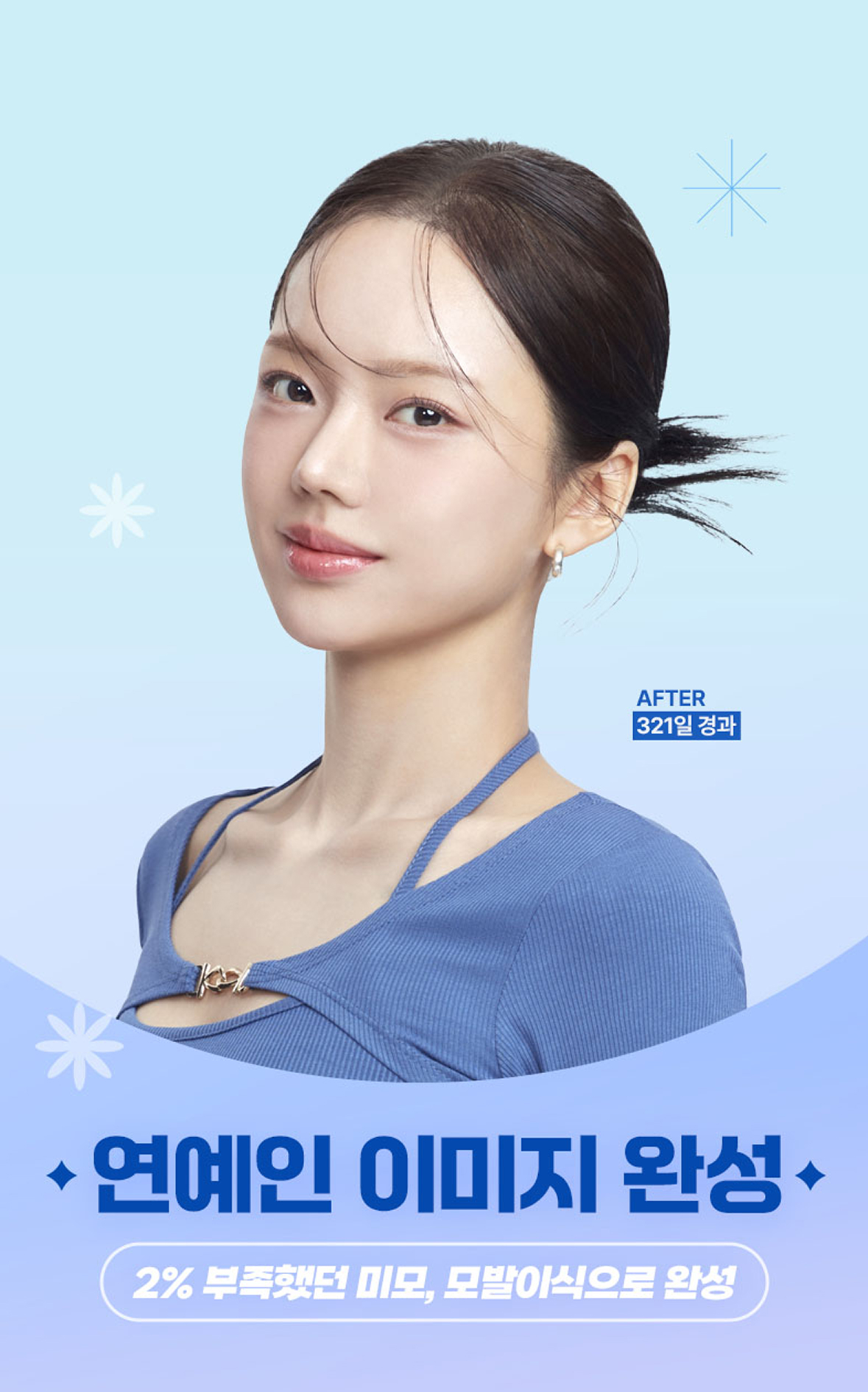 연예인 이미지 완성, 2%부족했던 미모, 모발이식으로 완성