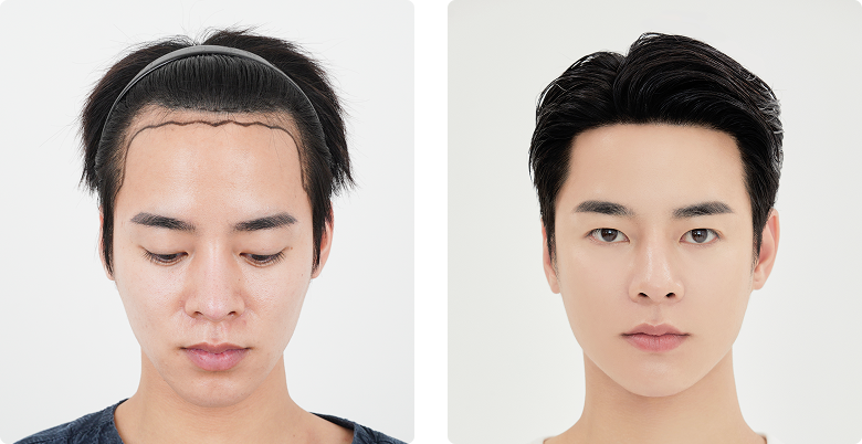 리얼포토후기 정면