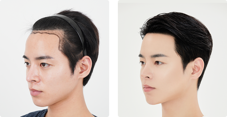 리얼포토후기 측면