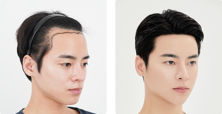 리얼포토후기 측면