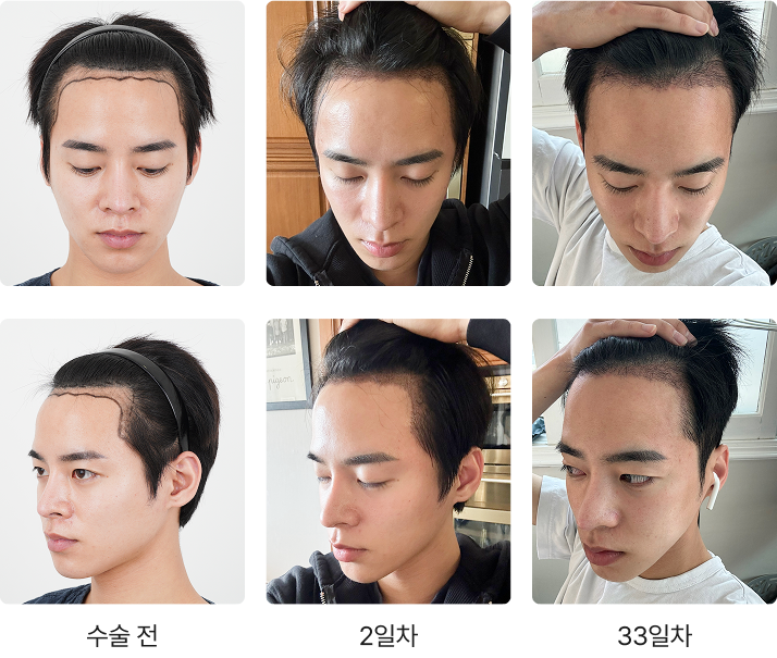 359일 간의 리얼 변화