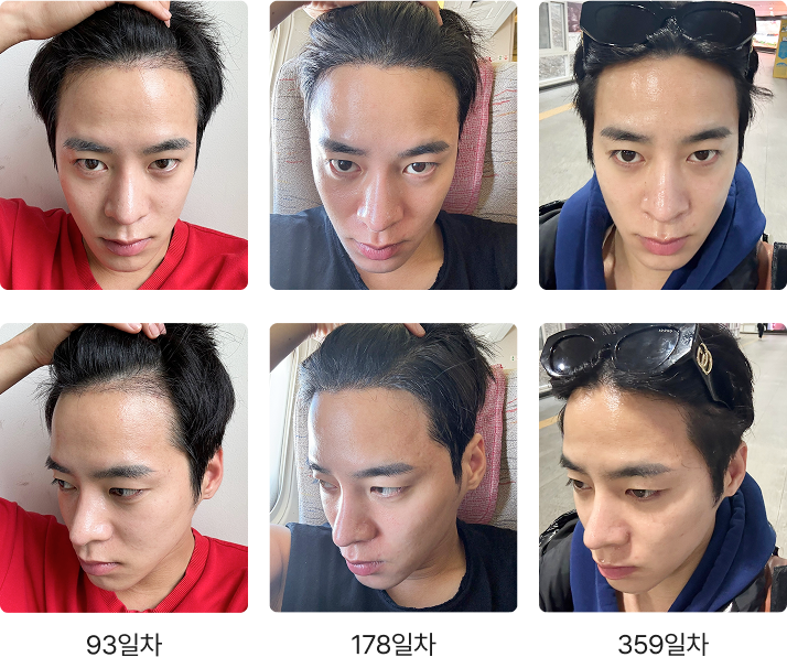 359일 간의 리얼 변화