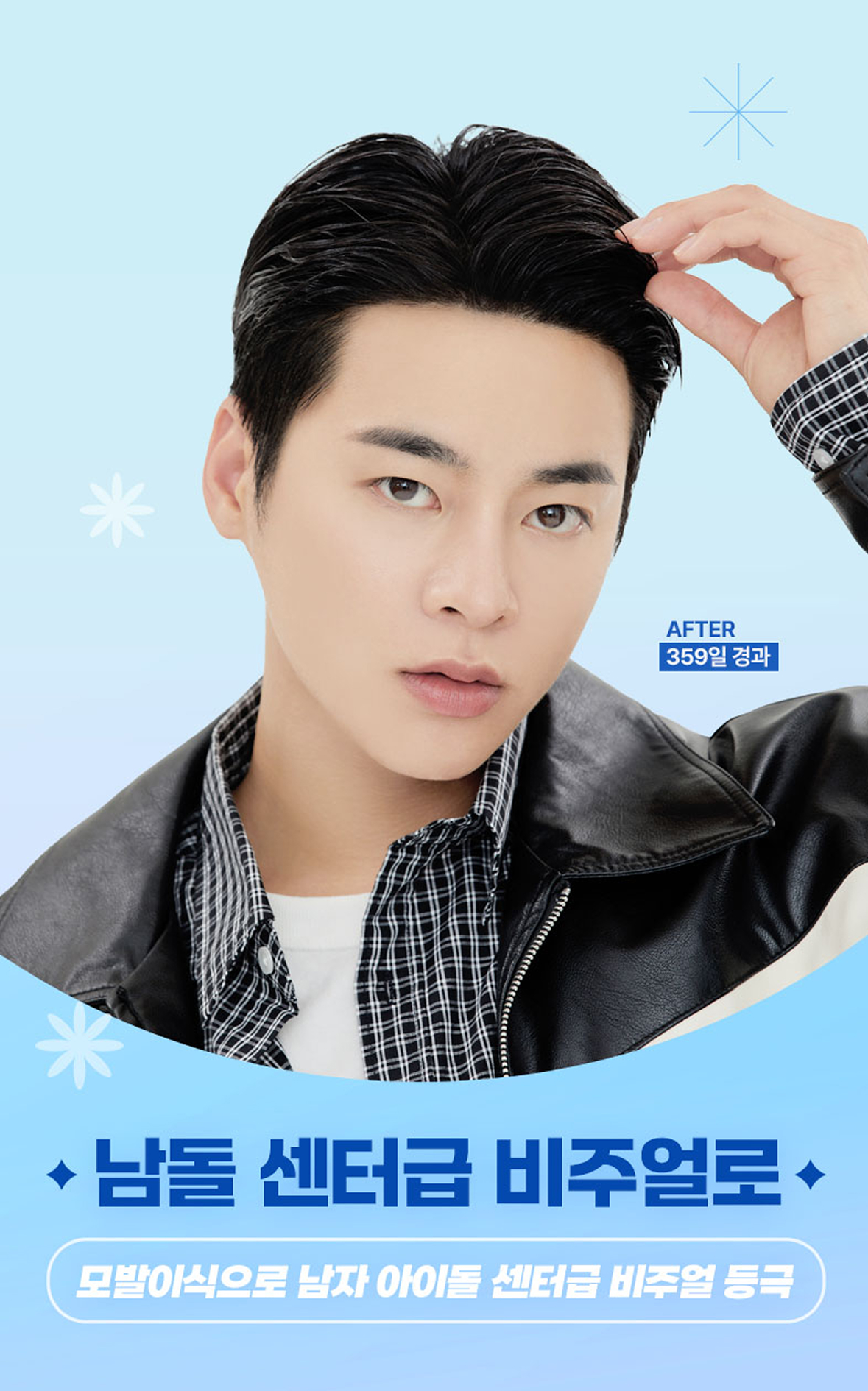 남돌 센터급 비주얼로, 모발이식으로 남자 아이돌 센터급 비주얼 등극