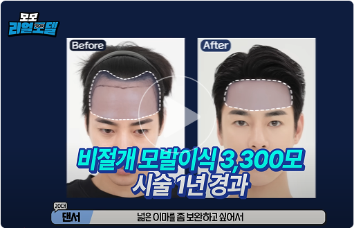 모모 리얼모델 썸네일1