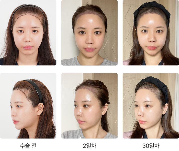 368일 간의 리얼 변화