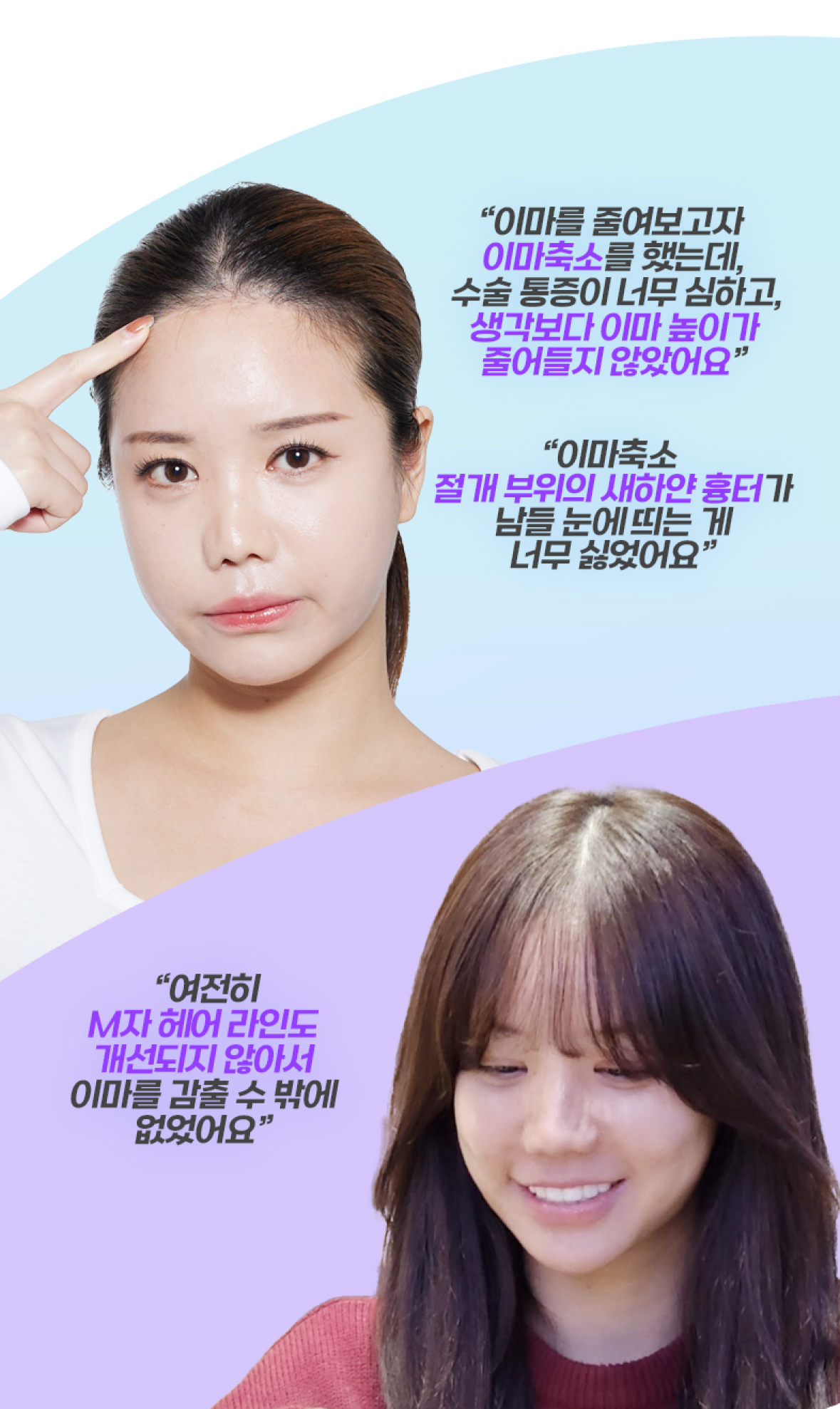 모발이식 필요성