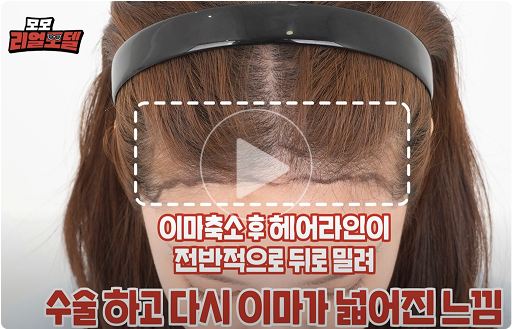 모모 리얼모델 썸네일1