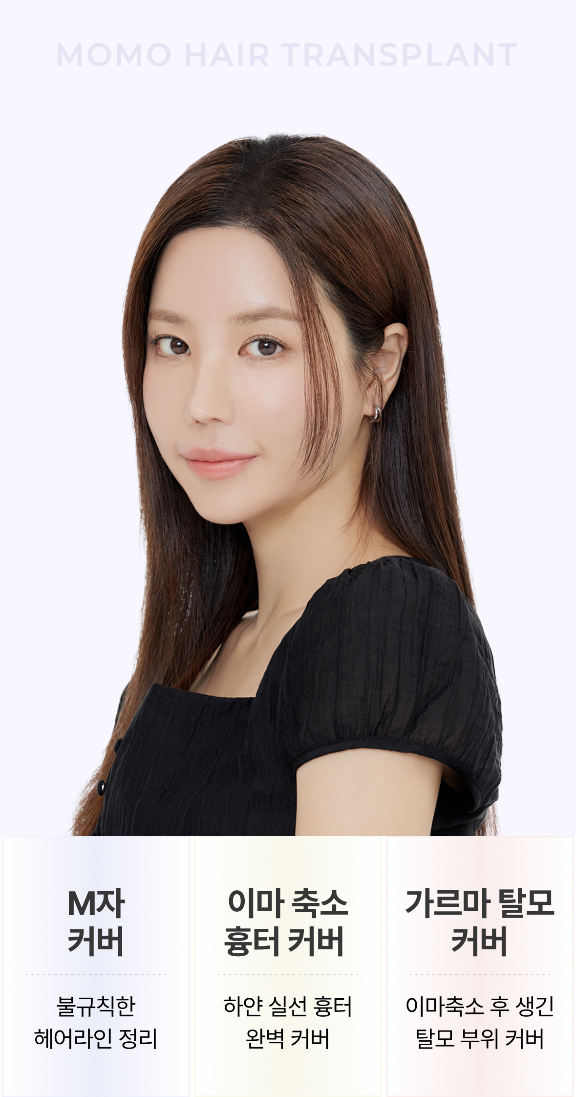 M자 커버 : 불규칙한 헤어라인 정리/ 이마축소 흉터 커버 : 하얀 실선 흉터 완벽 커버 / 가르마 탈모 커버: 이마축소 후 생긴 탈모 부위 커버