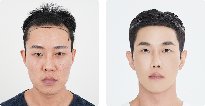 리얼포토후기 정면