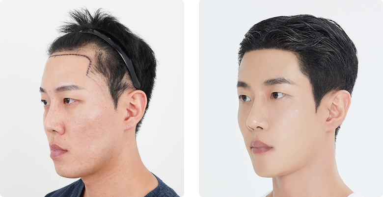 리얼포토후기 측면