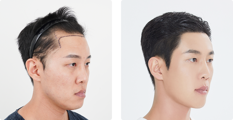 리얼포토후기 측면