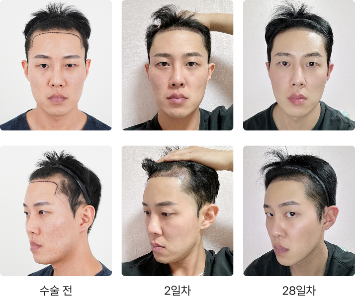 428일 간의 리얼 변화