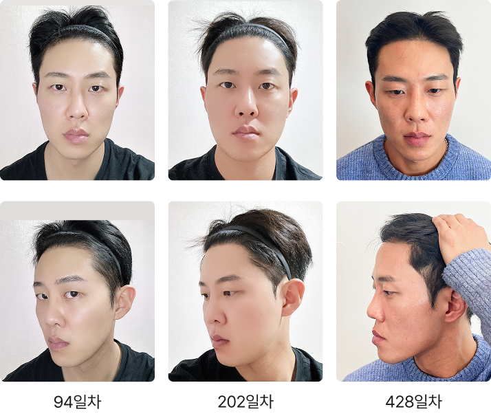 428일 간의 리얼 변화