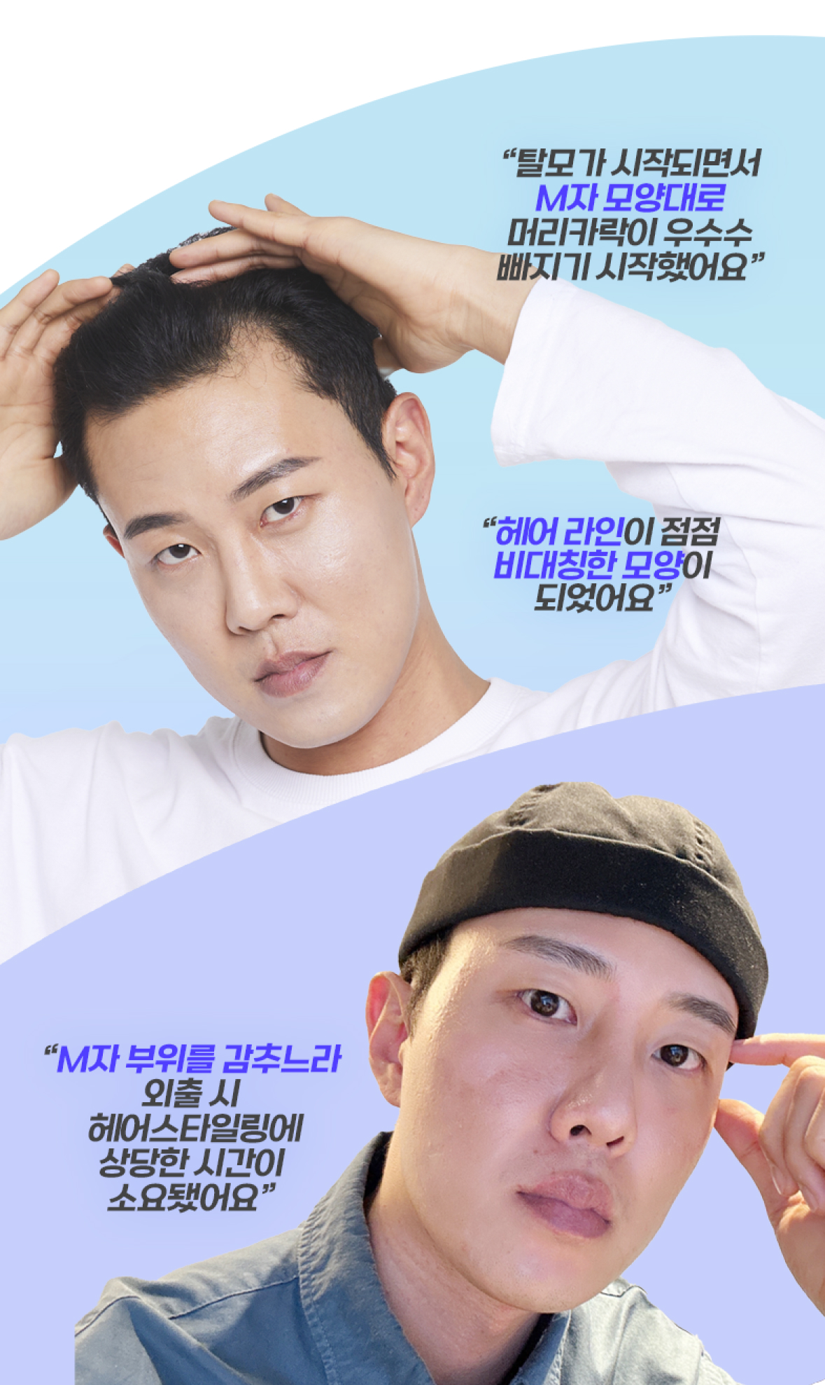 모발이식 필요성