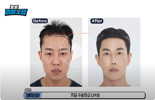 모모 리얼모델 썸네일3