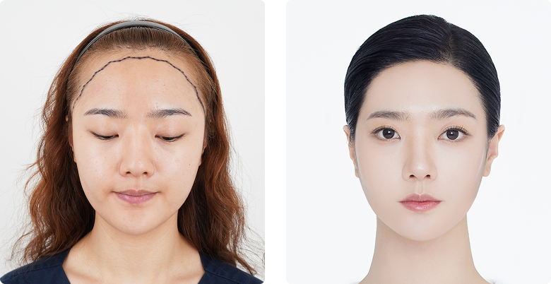 리얼포토후기 정면