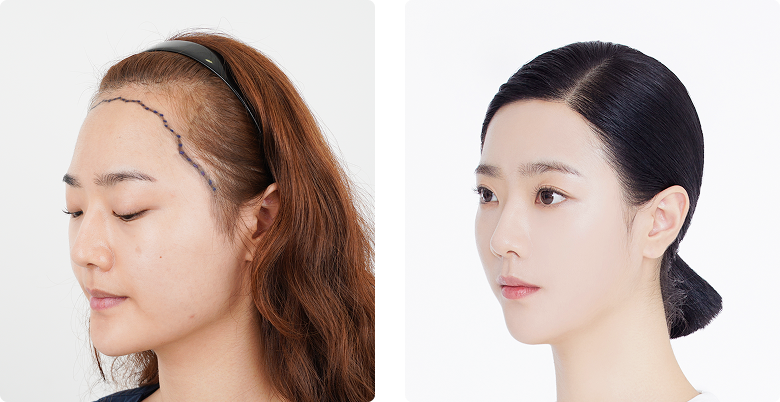 리얼포토후기 측면