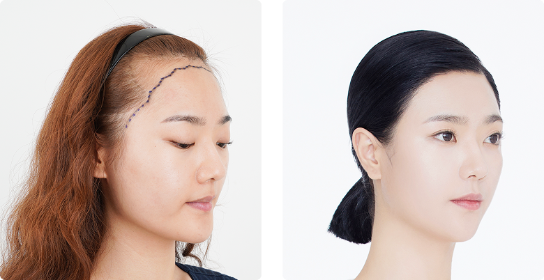 리얼포토후기 측면