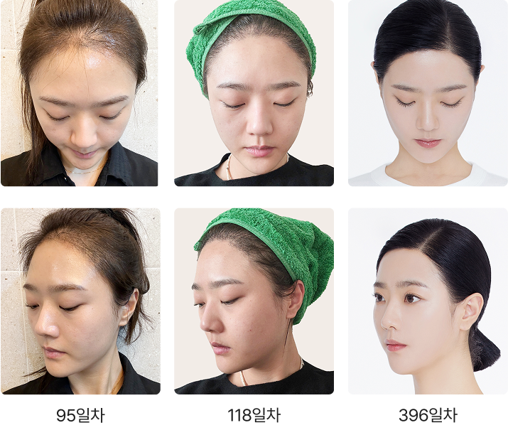 396일 간의 리얼 변화