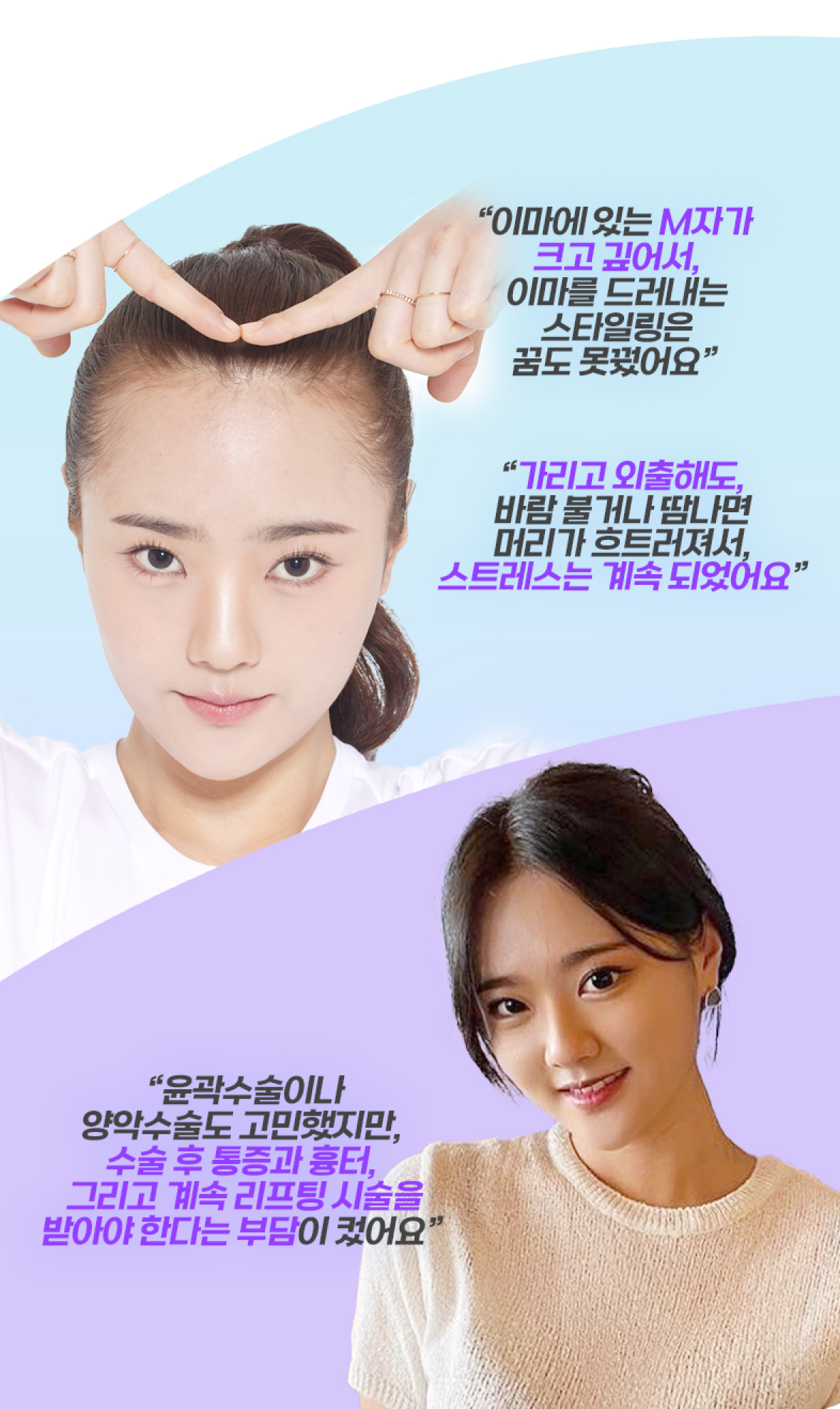 모발이식 필요성