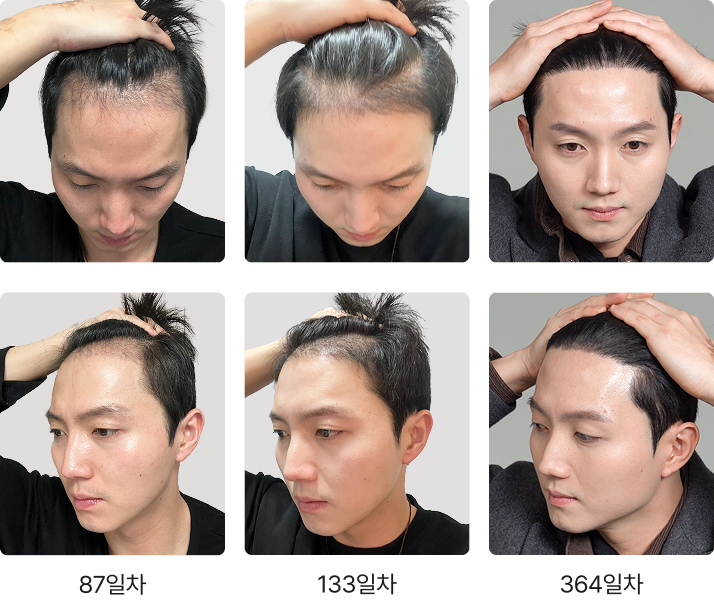 364일 간의 리얼 변화