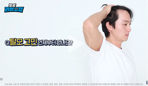 모모 수술상담 썸네일1