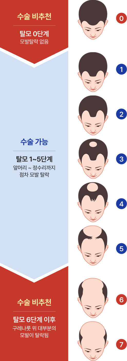 모발이식 골든 타임