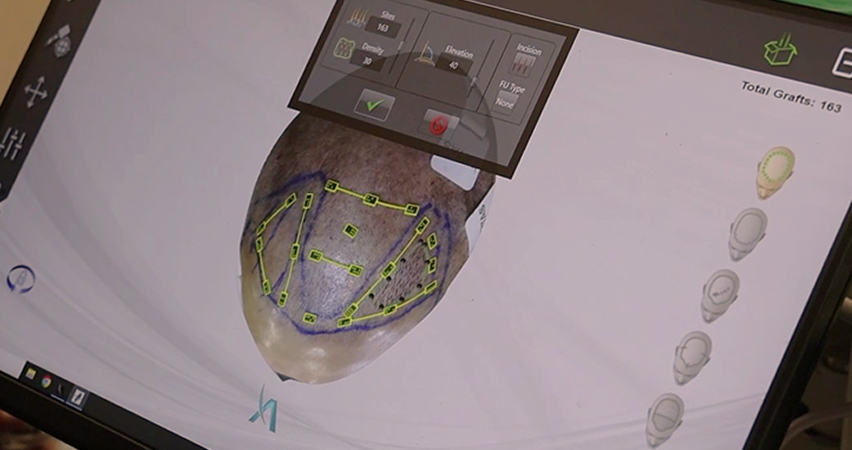 적은 편차와 손실