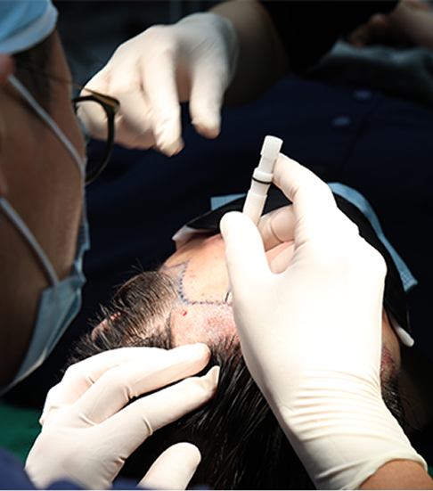 고도화된 테크닉 필요