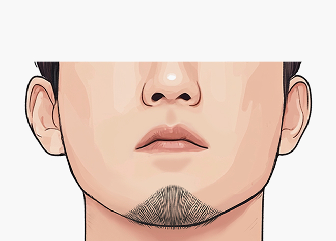 브이형드 구레나룻