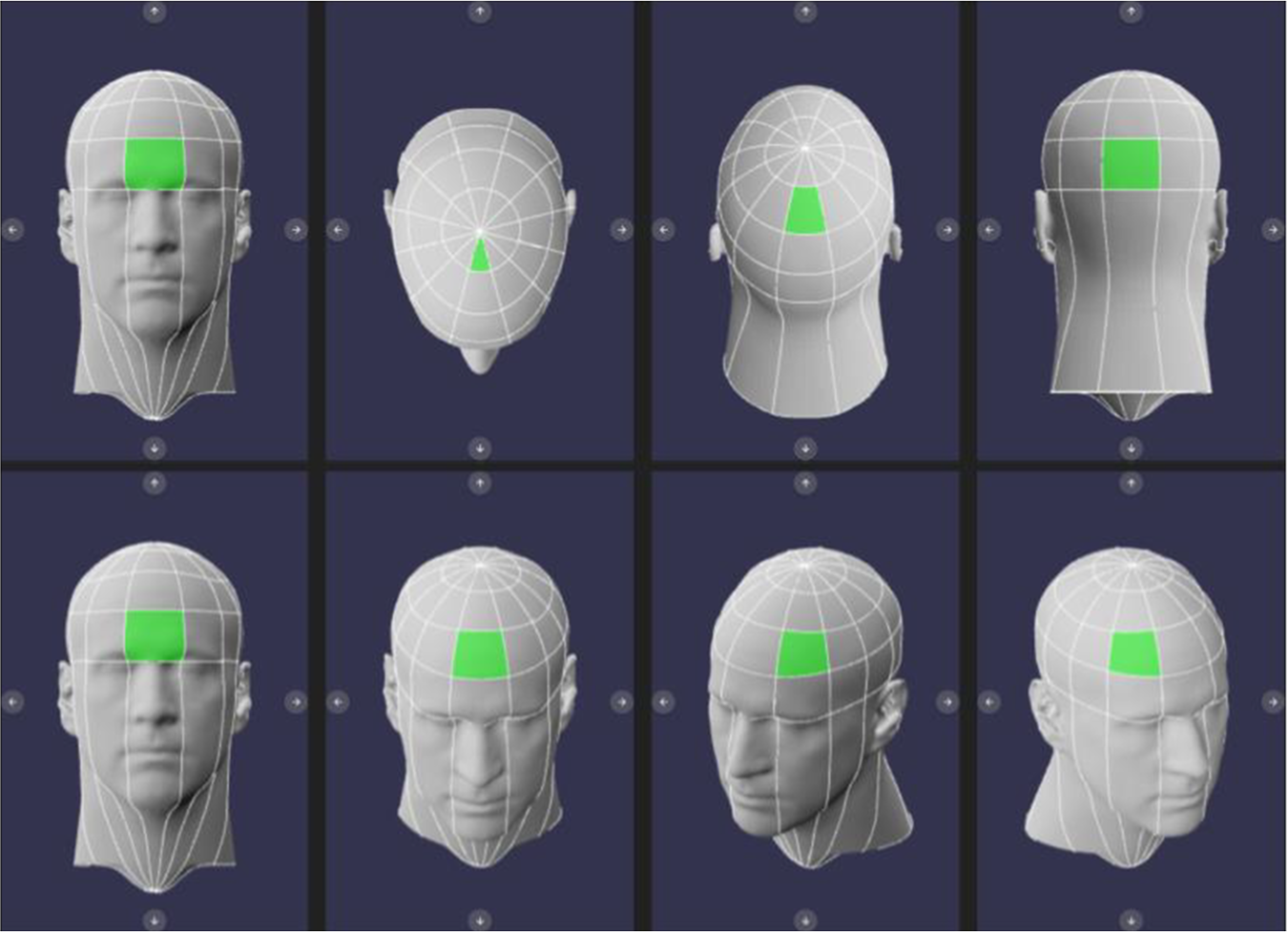 탈모 진단, 아프스 3D와 함께 합니다.