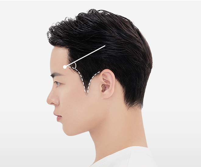 브이형드 구레나룻