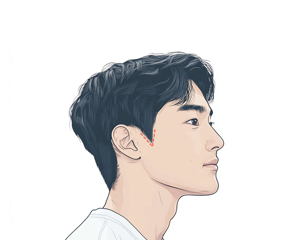 브이형 구레나룻