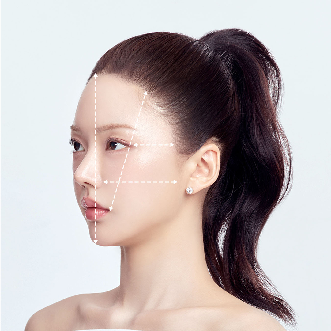 측면 비율 측정