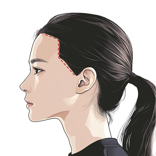 측면라인 디자인