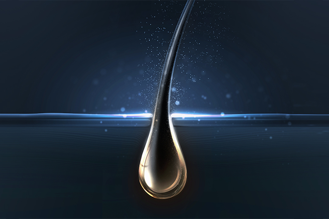 두피부터 관리하는 것이 진짜 치료입니다